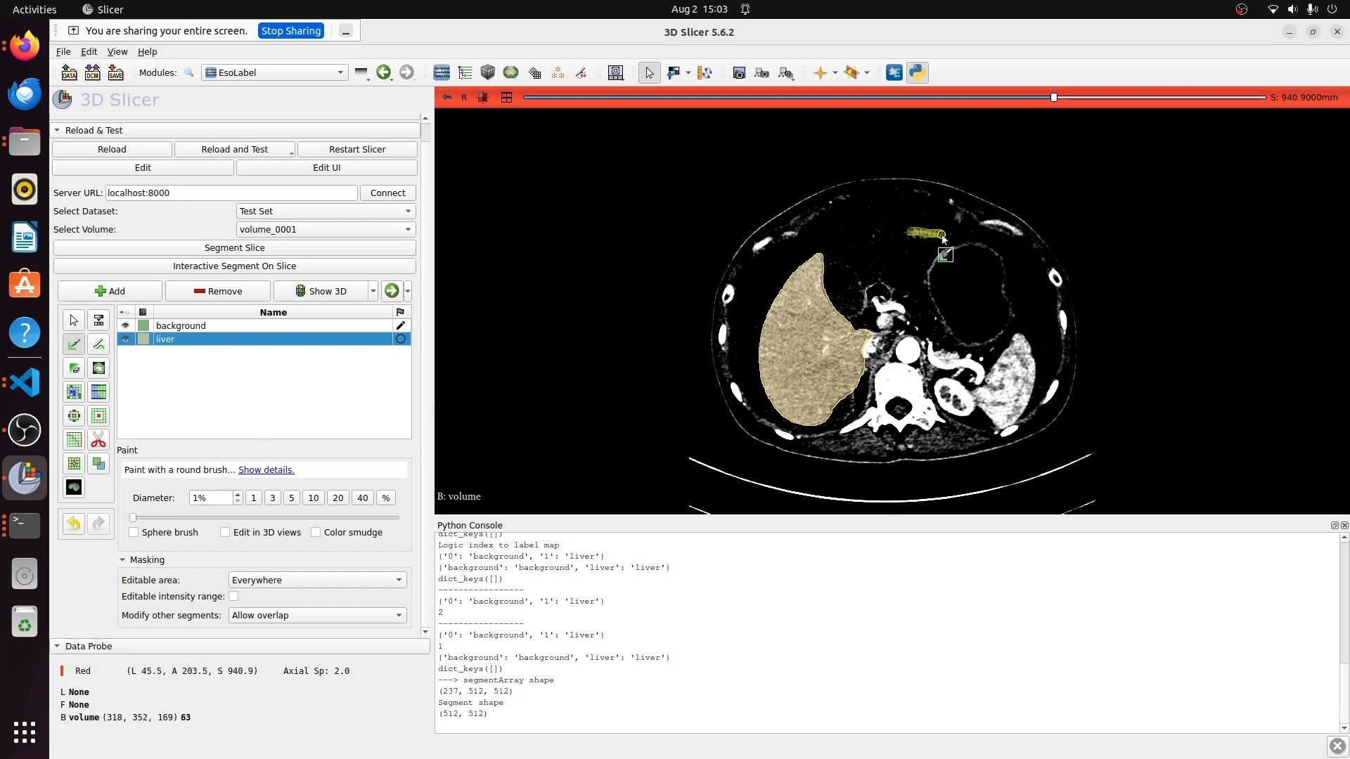 Interactive Medical Segmentation